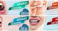 Aparat dentar