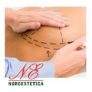 Nordestetica