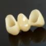 Coroana zirconiu 2