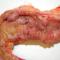 BOALA-CROHN