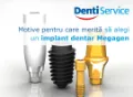 Implant dentar MegaGen