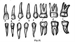 DENTANDU
