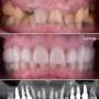 Clinica dentara Dr. Baldea - implantologie si reconstructie