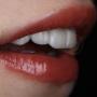 Implant dentar la Clinica Dentara Dr. Baldea