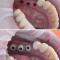 Implanturi-dentare
