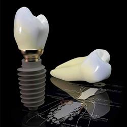 Implantfix - Clinica de implanturi dentare