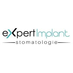 Expert Implant