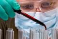 Hematologie