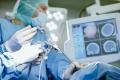 neurochirurgie