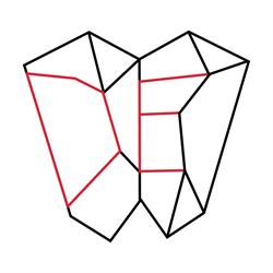 DentElite