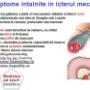 Icter mecanic simptome