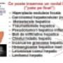 Nodul la ficat