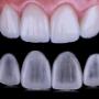 fatete dentare