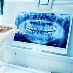 DentView Radiologie Dentara Digitala