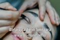 Blefaroplastie Timisoara