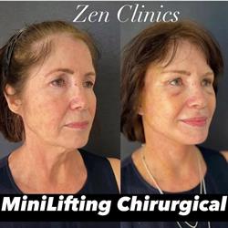 ZEN Clinics
