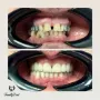Implant Dentar Family Dent Cluj