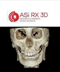 ASi RX 3D