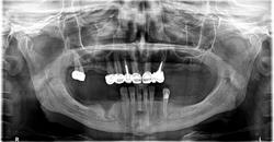 Dentist Mitrica