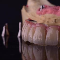 Dental Plan Lab