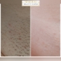 Rezultate epilare definitiva  before after