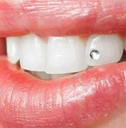 Denta smile