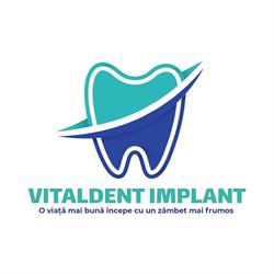 Vital Dent Implant