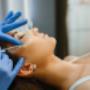 Dermato-estetica