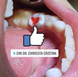 Cabinet Stomatologic Dr. Chiricuţă Cristina