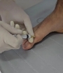 Terapie antiinflamatoare la Arch Kinetic Medical Brasov