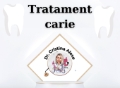 Tratament carie