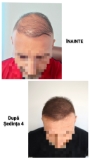 Efect de densitate