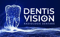 Dentis Vision