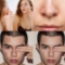Extractii acnee