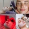 Lifting Anti Age