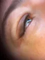 Micropigmentare Eyeliner Pleoape