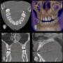 CBCT 1