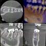 CBCT 2