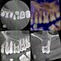 CBCT 3