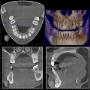 CBCT 4