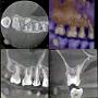 CBCT 5