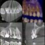 CBCT 6