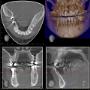 CBCT 7