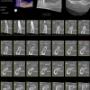 Cross Sections + Masuratori CBCT