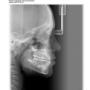 Încărcat de vizitator în 02.09.2015  - CRANIU DE PROFIL (LL) DIGITAL in format redus