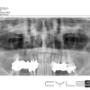 Încărcat de vizitator în 02.09.2015  - SINUSURI MAXILARE - FILM DIGITAL