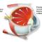 Glaucomul