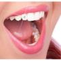 Bijuterii dentare