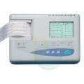 Electrocardiograma (ECG sau EKG)