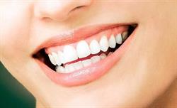 Smiley Dent